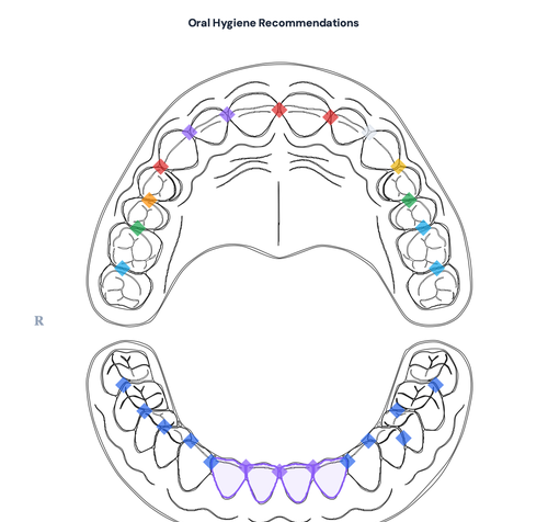 Oral hygiene recommendations chart with interdental brush sizes and tooth diagram